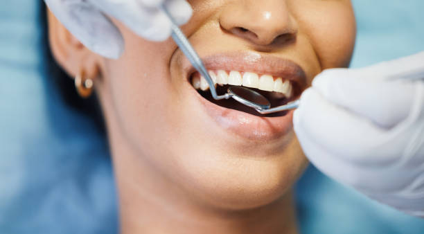 Best Dentist for Tooth Abscess  in Springville, UT